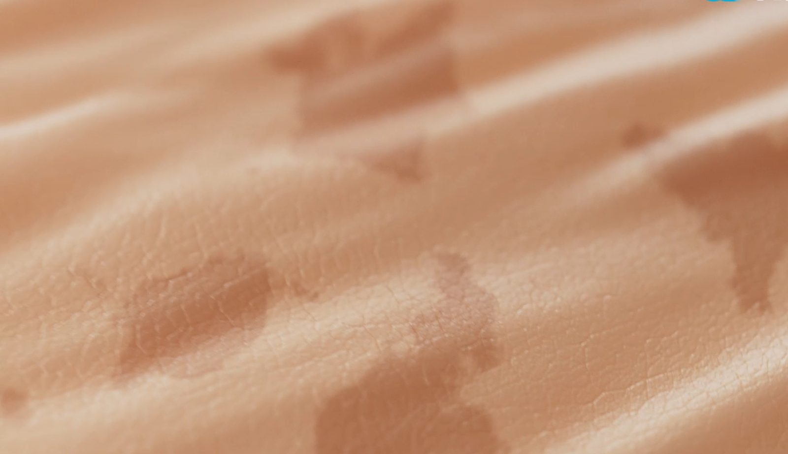 Skin health
