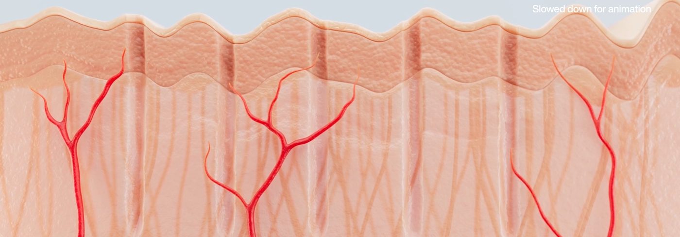 Illustration of the layers of the skin and the collagen network